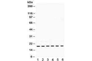 Image no. 2 for anti-Protein tyrosine Phosphatase Type IVA, Member 2 (PTP4A2) antibody (ABIN4952318)