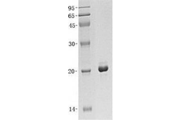 MAX Protein (Transcript Variant 1) (His tag)