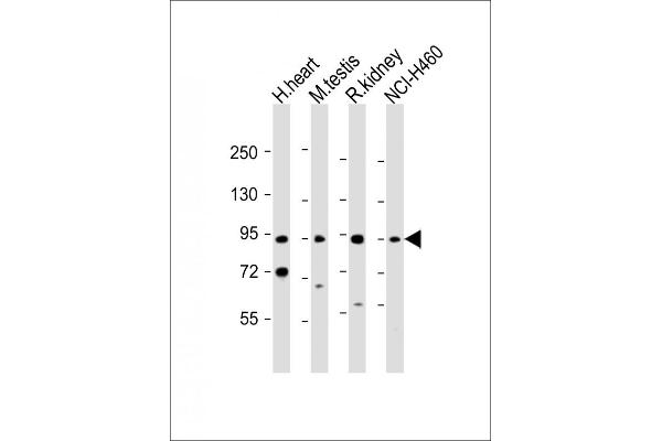 PDE1C antibody  (AA 375-409)