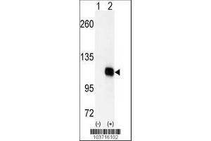 Image no. 1 for anti-Diacylglycerol Kinase, zeta (DGKZ) (AA 989-1019), (C-Term) antibody (ABIN392631)