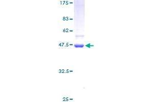 STK32A Protein (serine/threonine Kinase 32A) (AA 1-166) (GST tag)