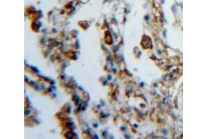 Image no. 1 for anti-Feline Sarcoma Oncogene (FES) (AA 510-770) antibody (ABIN5013541)