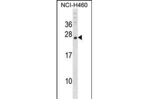 CSRP3 Antibody (Center) (ABIN1538690 and ABIN2848656) western blot analysis in NCI- cell line lysates (35 μg/lane).