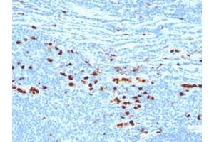 S100A8/A9 Complex (Calprotectin) anticorps