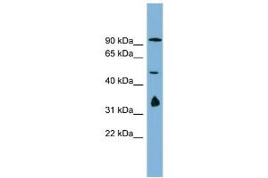 Image no. 2 for anti-MAK10 Homolog, Amino-Acid N-Acetyltransferase Subunit (MAK10) (N-Term) antibody (ABIN2782587)