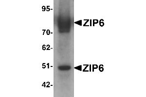 Western Blotting (WB) image for anti-Solute Carrier Family 39 (Zinc Transporter), Member 6 (SLC39A6) (Middle Region) antibody (ABIN1031182)