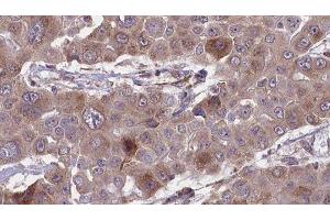 Image no. 2 for anti-Carcinoembryonic Antigen-Related Cell Adhesion Molecule 5 (CEACAM5) (Internal Region) antibody (ABIN6260741)