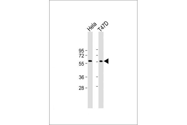 USP21 抗体  (N-Term)