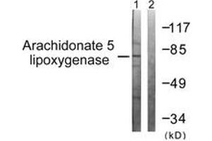 Image no. 1 for anti-Arachidonate 5-Lipoxygenase (ALOX5) (AA 246-295) antibody (ABIN1532500)