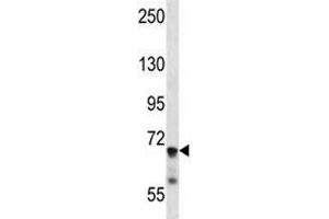 Image no. 2 for anti-Interleukin 1 Receptor, Type I (IL1R1) (AA 422-450) antibody (ABIN3031430)