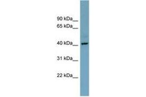 Image no. 1 for anti-Chromosome X Open Reading Frame 66 (CXorf66) (AA 215-264) antibody (ABIN6743320)