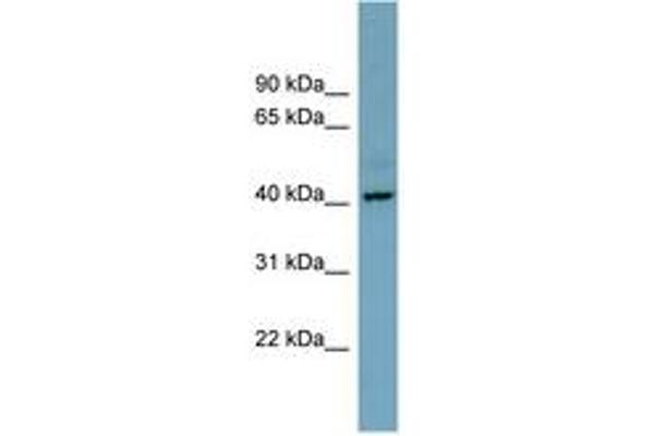 CXorf66 Antikörper  (AA 215-264)