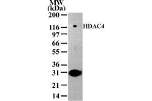 Image no. 1 for anti-Histone Deacetylase 4 (HDAC4) (AA 194-209) antibody (ABIN6971717)