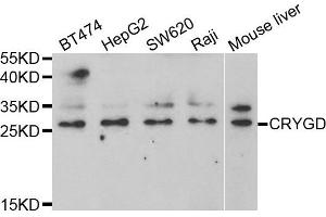Image no. 1 for anti-Crystallin, gamma D (CRYGD) antibody (ABIN2562027)