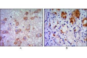 Image no. 2 for anti-Endoplasmic Reticulum To Nucleus Signaling 1 (ERN1) (AA 282-433) antibody (ABIN969116)
