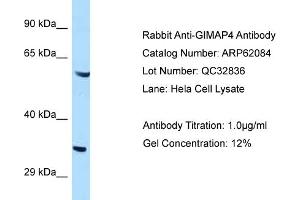 Image no. 1 for anti-GTPase, IMAP Family Member 4 (GIMAP4) (C-Term) antibody (ABIN2789011)