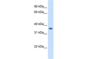Image no. 1 for anti-Aldo-Keto Reductase Family 1, Member B10 (Aldose Reductase) (AKR1B10) antibody (ABIN2462603)