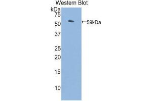 Image no. 1 for anti-Protein S (PROS) (AA 261-496) antibody (ABIN1860321)