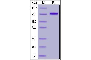Image no. 2 for Interleukin 17 Receptor E (IL17RE) (AA 155-454) (Active) protein (Fc Tag) (ABIN6950995)