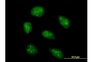 Image no. 2 for anti-Absent in Melanoma 2 (AIM2) (AA 1-343) antibody (ABIN522906)