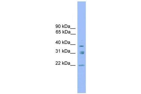 RNF167 Antikörper  (Middle Region)
