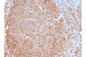 Image no. 5 for anti-MHC Class II HLA-DP/DQ/DR antibody (ABIN6941452)