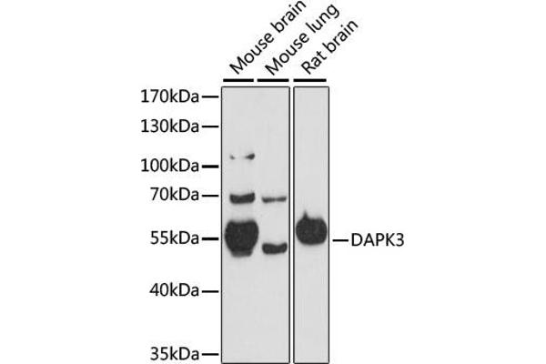DAPK3 Antikörper  (AA 1-100)
