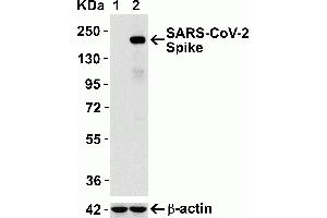 Western Blotting (WB) image for anti-SARS-CoV-2 Spike (C-Term) antibody (ABIN1030641)