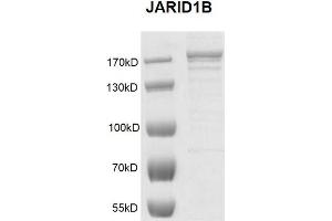 Western Blotting (WB) image for Lysine (K)-Specific Demethylase 5B (KDM5B) (full length ) protein (DYKDDDDK Tag) (ABIN2669681)