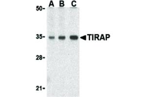Image no. 1 for anti-Toll-Interleukin 1 Receptor (TIR) Domain Containing Adaptor Protein (TIRAP) (C-Term) antibody (ABIN6657737)