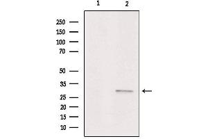 Image no. 3 for anti-Alkaline Ceramidase 1 (ACER1) antibody (ABIN6260068)