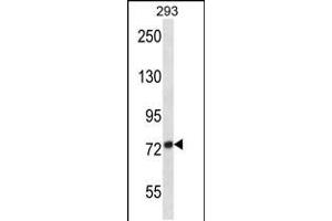 Image no. 1 for anti-ADAM Metallopeptidase Domain 32 (ADAM32) (AA 141-169), (N-Term) antibody (ABIN5536886)