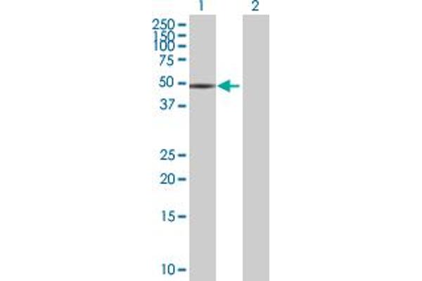 anti-Xylulokinase (XYLB) (AA 1-536) antibody