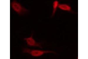 Image no. 7 for anti-Signal Transducer and Activator of Transcription 1, 91kDa (STAT1) (pSer727) antibody (ABIN6256410)