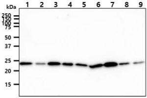 CINP antibody