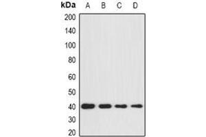 Image no. 2 for anti-Guanine Nucleotide Binding Protein (G Protein), alpha 11 (Gq Class) (GNA11) (full length) antibody (ABIN6043480)