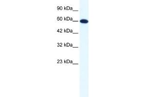 Image no. 1 for anti-DEAD (Asp-Glu-Ala-Asp) Box Polypeptide 6 (DDX6) (N-Term) antibody (ABIN2775194)