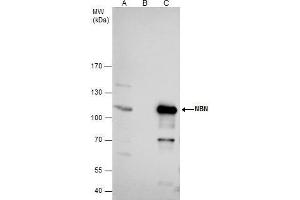 Image no. 1 for anti-NLR Family, Pyrin Domain Containing 2 (NLRP2) (Center) antibody (ABIN2855584)