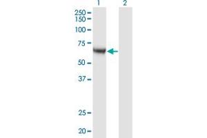 Western Blot analysis of CAMKK1 expression in transfected 293T cell line by CAMKK1 monoclonal antibody (M04), clone 4A11.