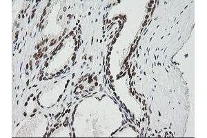 Image no. 4 for anti-Zinc Finger and SCAN Domain Containing 18 (ZSCAN18) antibody (ABIN1501857)