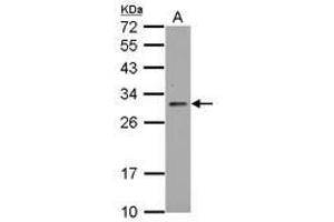 Image no. 1 for anti-TP53 induced glycolysis regulatory phosphatase (TIGAR) (AA 1-270) antibody (ABIN1497017)