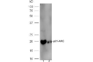 Line1,mouse intestinal lysate; Line2, Raji lysate probed with Rabbit Anti-p21-ARC Polyclonal Antibody, Unconjugated (ABIN2178124) at 1:300 in 4˚C.