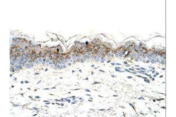 anti-GTP Binding Protein Overexpressed in Skeletal Muscle (GEM) (AA 219-270) antibody