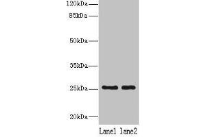 NDFIP1 Antikörper  (AA 2-116)