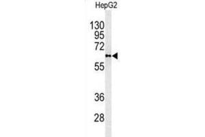 Image no. 3 for anti-Phospholipid Transfer Protein (PLTP) antibody (ABIN3003343)