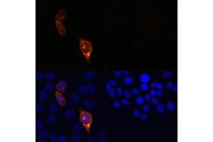Immunofluorescence (IF) image for anti-CRISPR-Cas9 antibody (ABIN7266523)