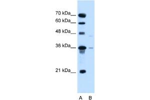 Image no. 1 for anti-Solute Carrier Family 17 (Anion/Sugar Transporter), Member 3 (SLC17A3) (Middle Region) antibody (ABIN2775342)