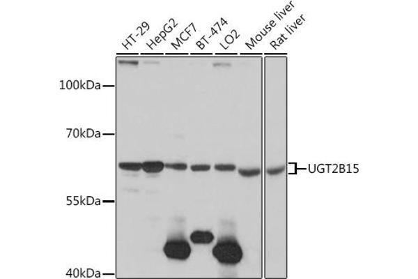 UGT2B15 Antikörper  (AA 60-190)