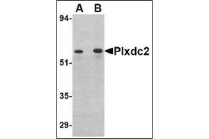 Image no. 2 for anti-Plexin Domain Containing 2 (PLXDC2) (C-Term) antibody (ABIN500517)