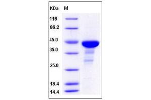 Cell Division Cycle 42 (GTP Binding Protein, 25kDa) (CDC42) (AA 1-188), (Mature) protein (GST tag)